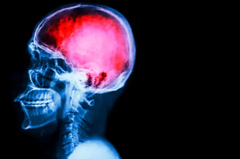 Especialización en Neurocirugía