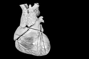 Especialización en Cardiología  Intervencionista y Hemodinamia