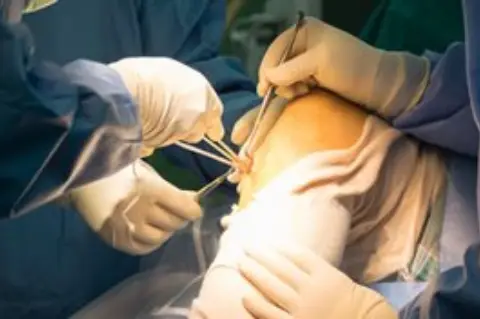 Especialización en Cirugía Vascular Periférica