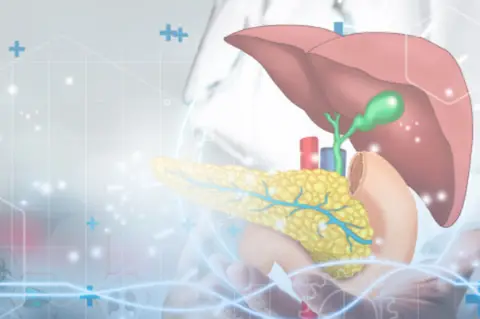 Entrenamiento Avanzado en  Cirugía Hepatobiliar y  Pancreática