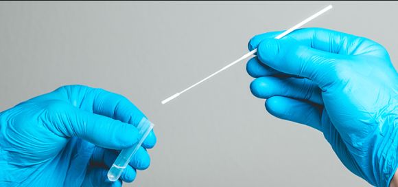 Los avances que dejó el COVID-19 para mejorar el diagnóstico molecular de enfermedades infecciosas en Colombia 